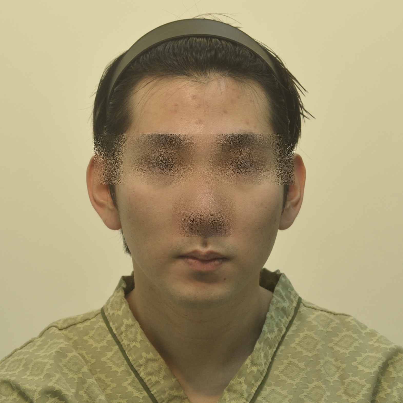 치료 전 이미지